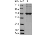 Recombinant Human PON3/Paraoxonase 3 Protein (50 Ser/Asn, His Tag)