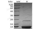 Recombinant Human Resistin Protein (aa 17-108, Fc Tag)