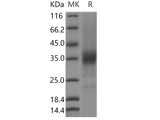 Recombinant Human KIR2DL4/CD158D Protein