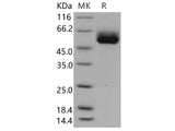 Recombinant Human IL1RL1/ST2 Protein (isoform a, His Tag)(Active)