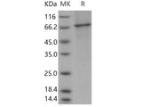 Recombinant Human PDE2A/CGS-PDE Protein (aa 215-900, His Tag)