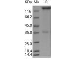 Recombinant Human SELP/selectin P/P-selectin Protein (Fc Tag)(Active)