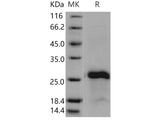 Recombinant Human IGJ/Immunoglobulin J Chain Protein (His Tag)