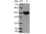 Recombinant Human EBP1/PA2G4 Protein (His Tag)