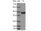 Recombinant Human/Mouse USP46 Protein