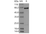 Recombinant Human/Mouse USP46 Protein (SUMO Tag)