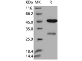 Recombinant Human Uracil-DNA glycosylase/UNG Protein (GST Tag)