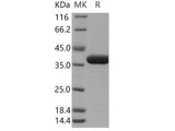 Recombinant Human OTUB1/OTB1 Protein (His Tag)