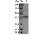 Recombinant Human CLDN11/Claudin-11 Protein (Fc Tag)