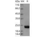 Recombinant Human PTPMT1 Protein (His Tag)(Active)