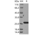 Recombinant Human CRADD/RAIDD Protein (His Tag)