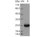 Recombinant Human UBE2F Protein (His Tag)