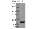 Recombinant Human Ube2H Protein