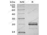 Recombinant Human MAX Protein (His &GST Tag)