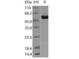 Recombinant Human ALDH4A1 Protein