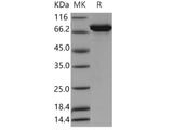 Recombinant Human ALDH4A1 Protein (His & GST Tag)