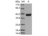 Recombinant Human SERPINB9/PI-9 Protein (Baculovirus, His Tag)