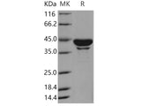 Recombinant Human SerpinB6/PI-6 Protein (His Tag)