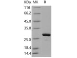 Recombinant Human MAD2L1/MAD2 Protein (His Tag)