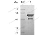 Recombinant Human STAT1 Protein (His &GST Tag)