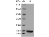 Recombinant Human UBE2W Protein (His Tag)