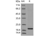 Recombinant Human TSC22D1 Protein (His Tag)