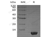 Recombinant Human Neuritin/NRN1 Protein (Baculovirus, His Tag)