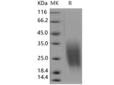 Recombinant Human CREB3L1/OASIS Protein (aa 396-519, His Tag)