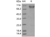 Recombinant Human BLNK/Ly-57 Protein (His Tag)(Active)