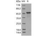 Recombinant Human ILKAP Protein (His Tag)