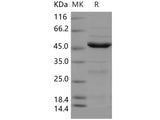 Recombinant Human NEIL1 Protein (His Tag)