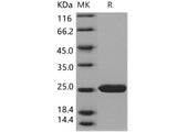 Recombinant Human SOD2/Mn-SOD Protein