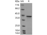 Recombinant Human HOXA1 Protein (His Tag)