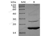 Recombinant Human Ube2L6 Protein (His Tag) 