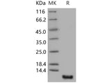 Recombinant Human S100P/S100E Protein