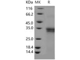 Recombinant Human IFI30 Protein (His Tag)