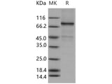 Recombinant Human ELK1 Protein (His & GST Tag)