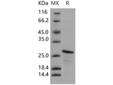 Recombinant Human CIB2/KIP-2 Protein (His Tag)