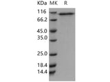 Recombinant Human CD93/C1QR1 Protein (aa 1-580, His Tag)