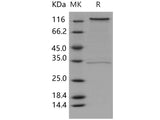 Recombinant Human CD93/C1QR1 Protein (Fc Tag)