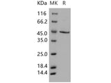 Recombinant Human SERPINB1/PI2 Protein (Baculovirus, His Tag)