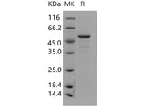 Recombinant Human FKBP3/FKBP25 Protein (GST Tag)