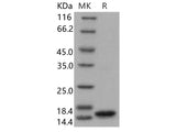 Recombinant Human FABP5 Protein