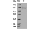 Recombinant Human GAD67/GAD1 Protein (His Tag)