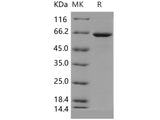 Recombinant Human GBP1 Protein (His Tag)