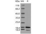 Recombinant Human CDK2AP2 Protein (E.coli, His Tag)