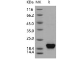 Recombinant Human NUDT2/Ap4A hydrolase Protein (His Tag)