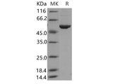 Recombinant Human ALDH3A1 Protein (Baculovirus, His Tag)