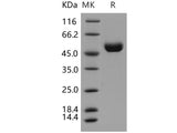 Recombinant Human Cathepsin D/CTSD Protein (His Tag)(Active)