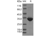 Recombinant Human BVES/POPDC1 Protein (GST Tag)